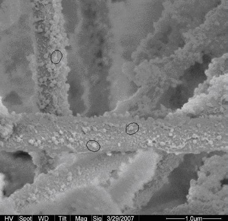 Vlákna z nanoaluminy so zachytenými bakteriálnymi bunkami